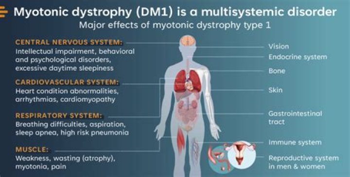 What type of mutation causes myotonic dystrophy?