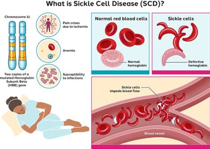 What type of mutation is sickle cell Anaemia most probably caused by?