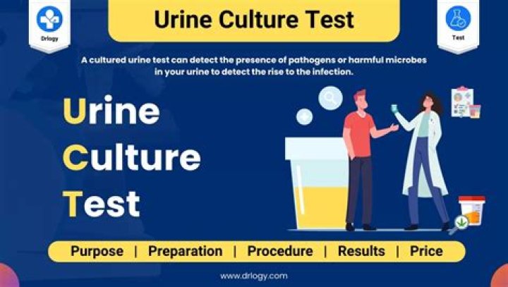 What will Dilaudid show up as in a urine test?