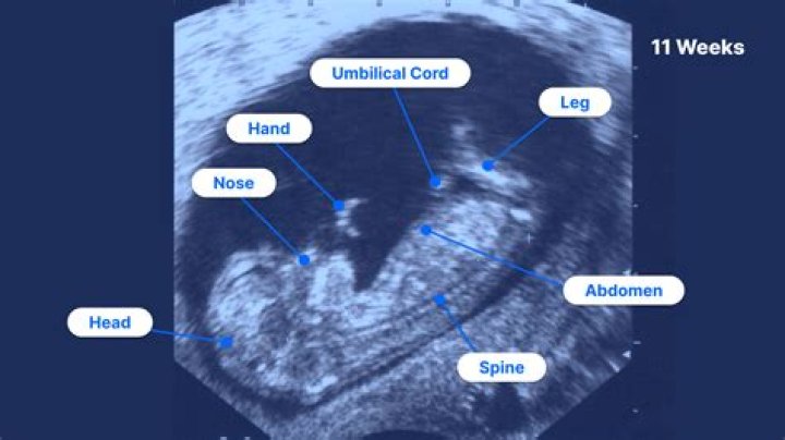 What will ultrasound show at 11 weeks?