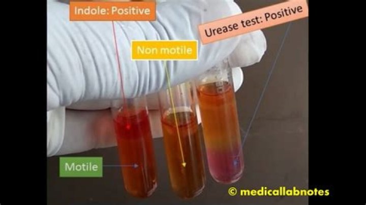 What would the organism be if it was urease-positive?