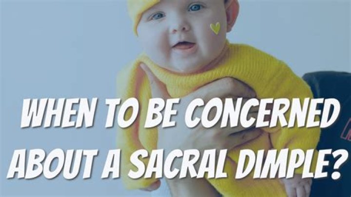 When should I be concerned about a sacral dimple?
