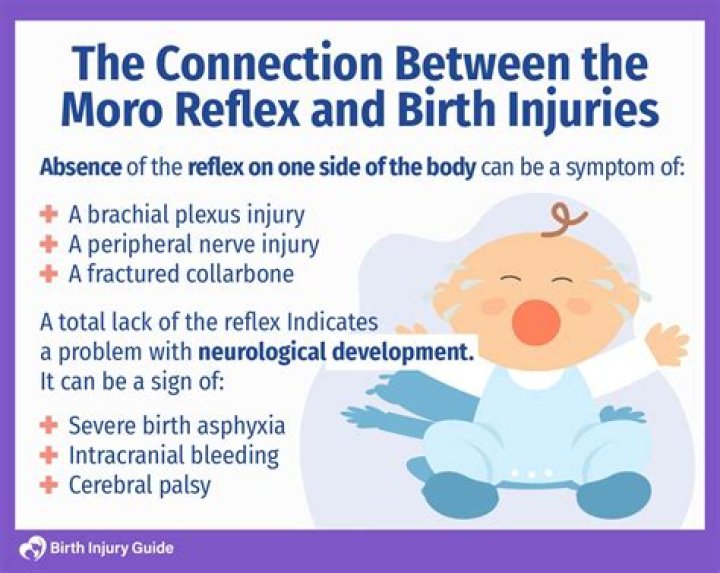 When should I be concerned about startle reflex?