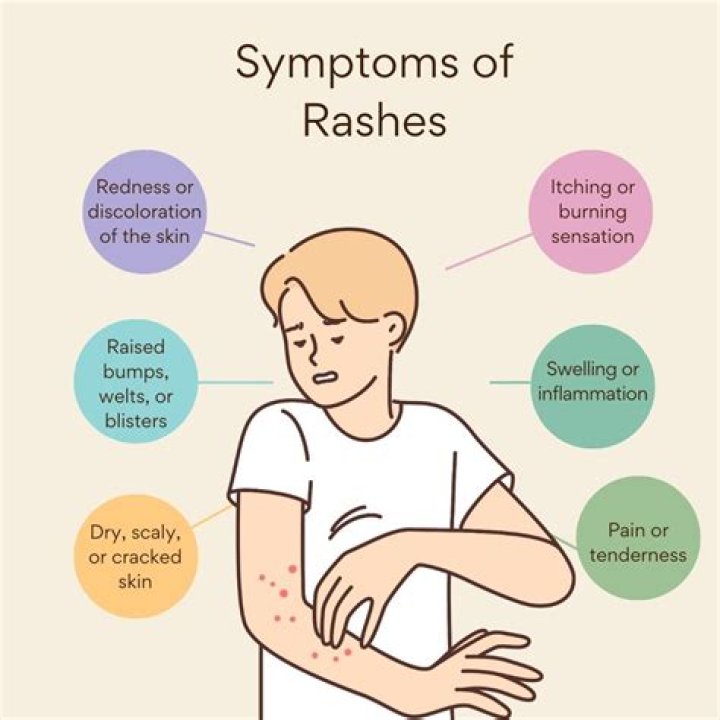 When should I be worried about a rash on my child?