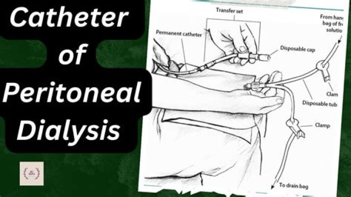 Where do they put a catheter in dialysis?