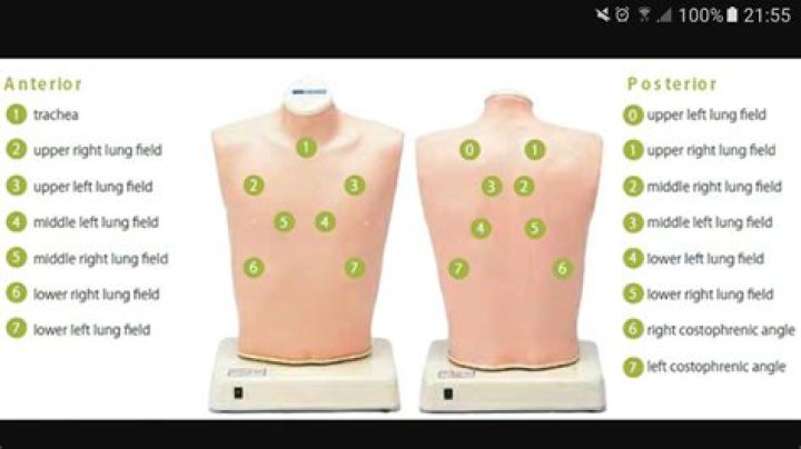 Where do you assess lung sounds?