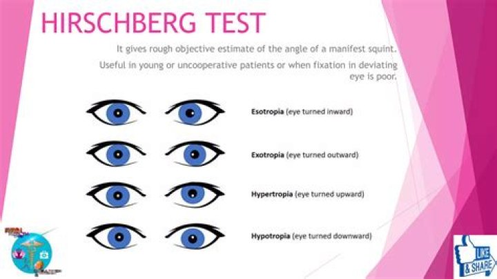 Which disorder of the eye can be detected with the cover Uncover and the Hirschberg test?