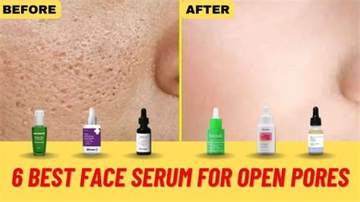 Which serum is best for pores?
