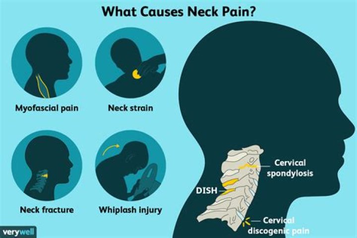 Why is my neck hurting so bad while pregnant?