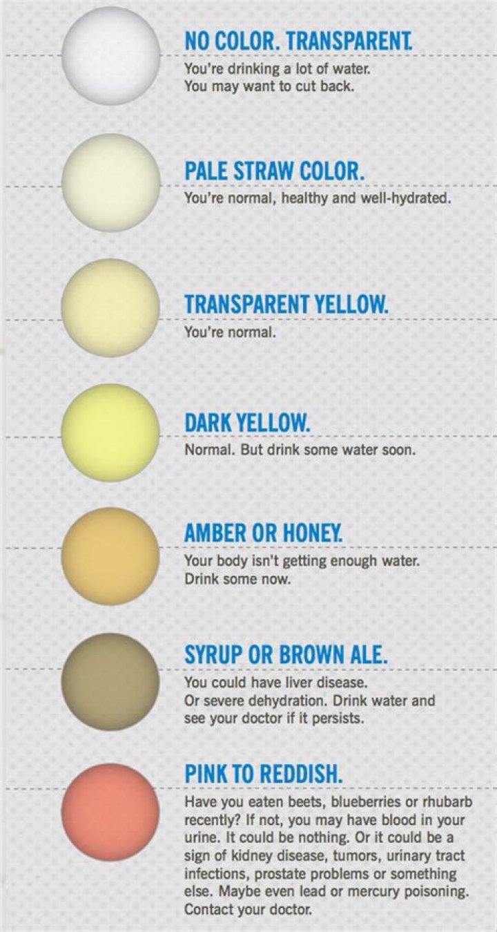 Why is my pee foggy and Brown?