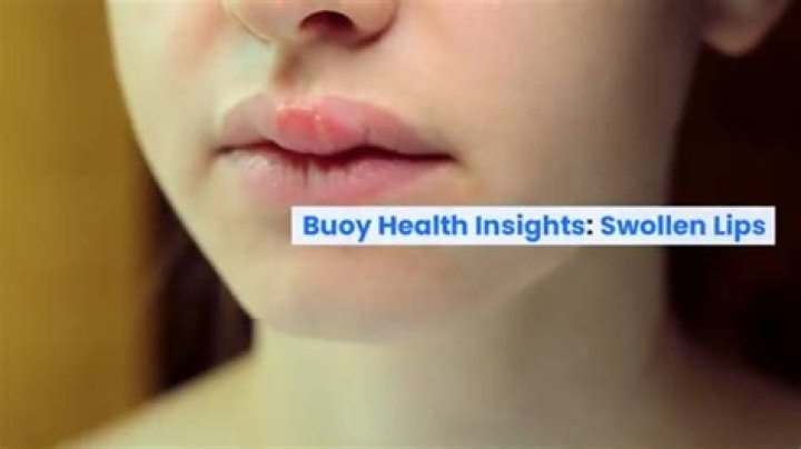 Why is the inside of my upper lip swollen?