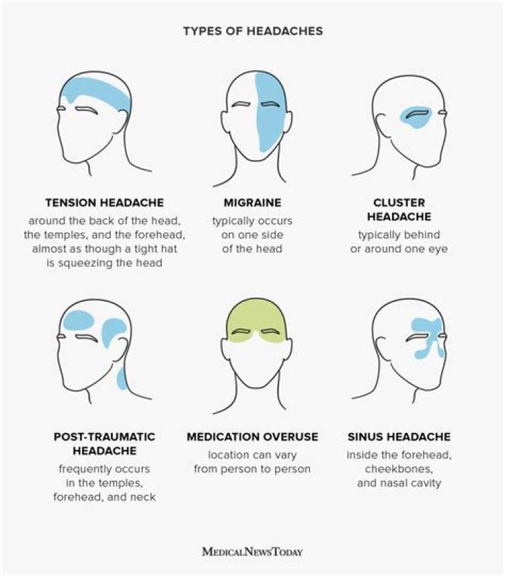 Why is the left side of my head hurting?