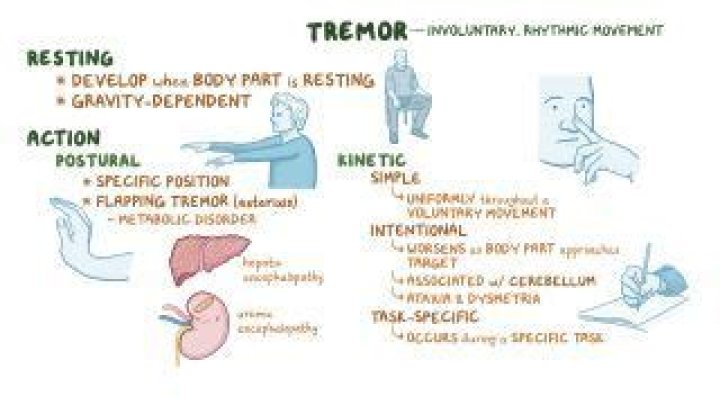 Why there is intention tremor in cerebellar disease?